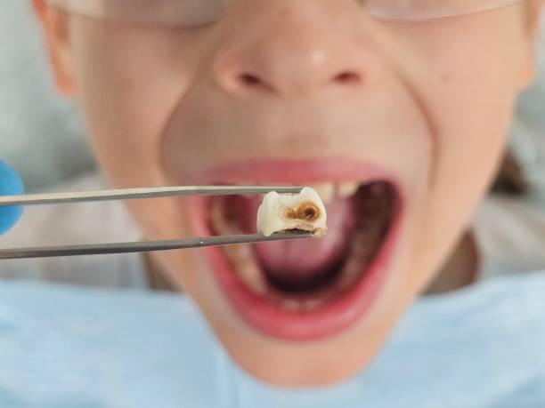 Best Pediatric Emergency Dentist in Bismarck, ND